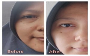 Serum Pencerah Wajah Terbaik